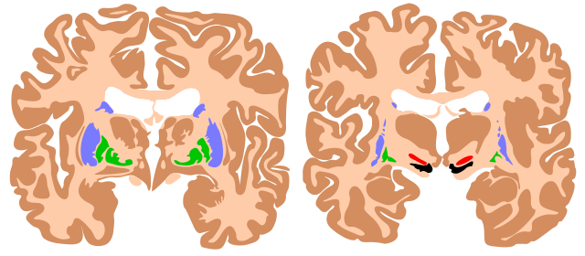 File:Basal ganglia.svg