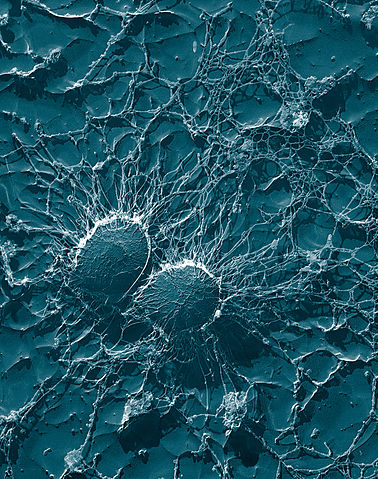 File:Staphylococcus aureus, 50,000x, USDA, ARS, EMU.jpg