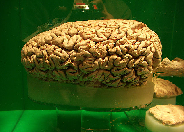 File:Preserved sperm whale brain.jpg