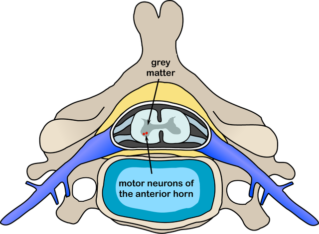 File:Polio spinal diagram.PNG