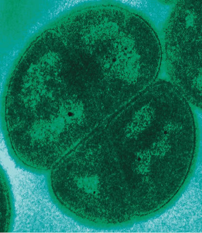 File:Deinococcus radiodurans.jpg