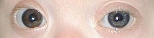 File:Brushfield eye crop.jpg