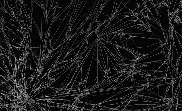 File:CaffeineCrystals Fibrous 10xDarkField.jpg