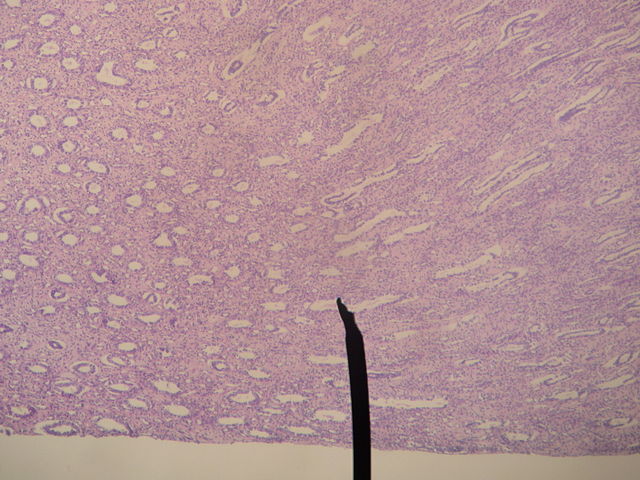 File:Kidney-medulla.JPG