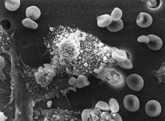 File:Macs killing cancer cell.jpg
