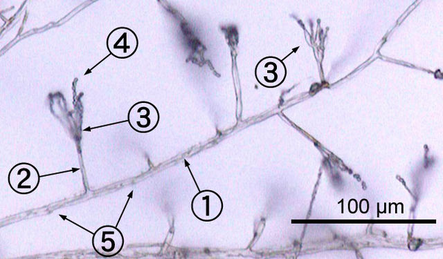 File:Penicillium labeled cropped.jpg