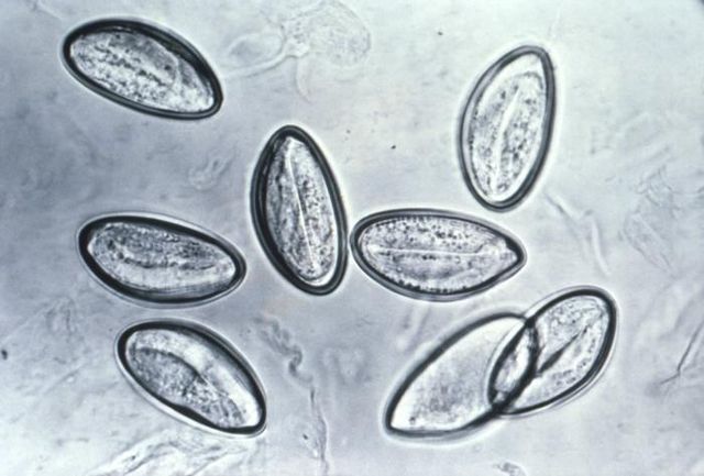 File:Eggs of Enterobius vermicularis 5229 lores.jpg