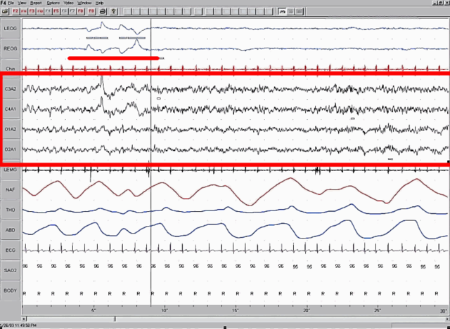 File:Sleep EEG REM.png