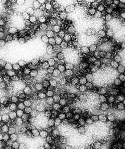 File:YellowFeverVirus.jpg