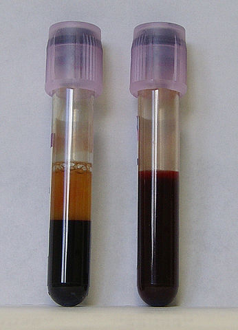 File:Blut-EDTA.jpg